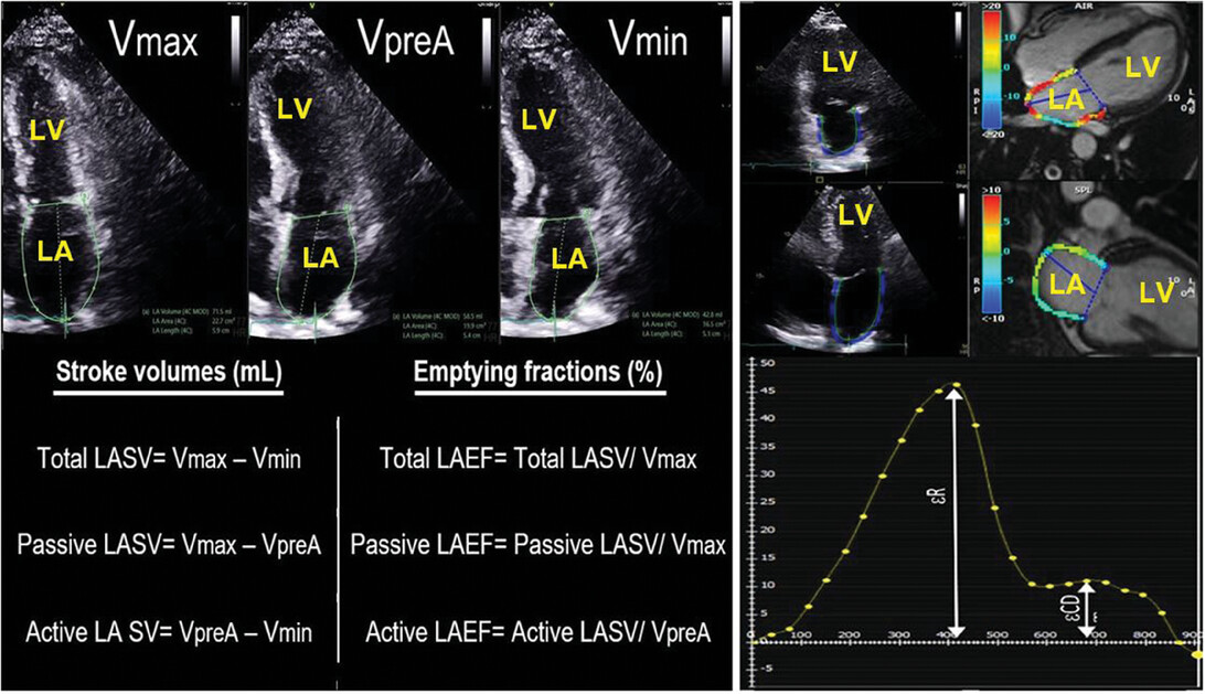 Left Atrial Markers in Diagnosing and Prognosticating Non-Ischemic Cardiomyopathies: Ready for Prime Time?
