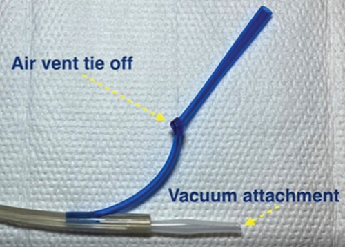 Details are in the caption following the image