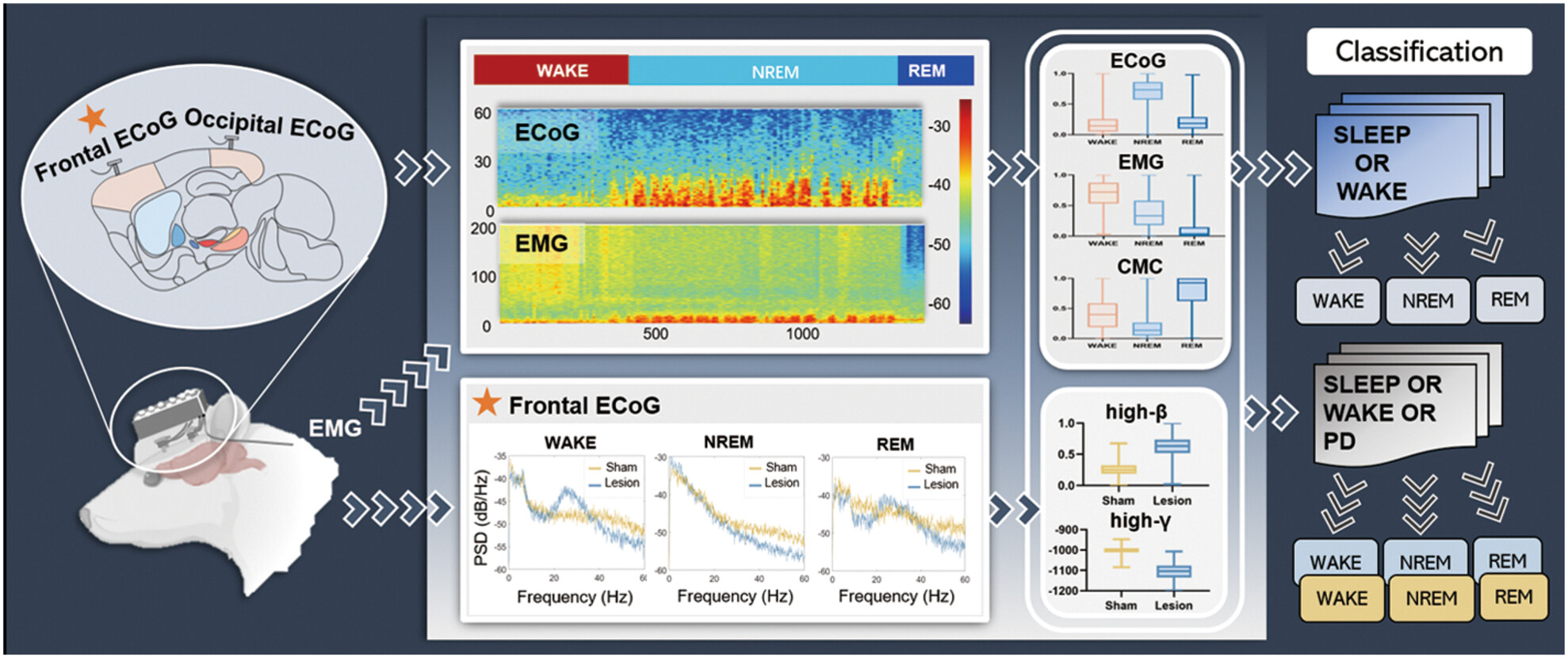 Automatic sleep–wake classification and Parkinson's disease recognition using multifeature fusion with support vector machine