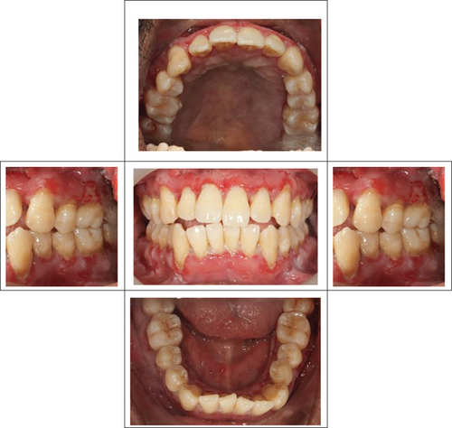 Details are in the caption following the image Details are in the caption following the image