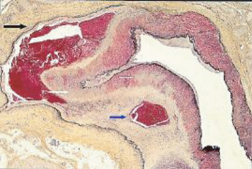 Details are in the caption following the image