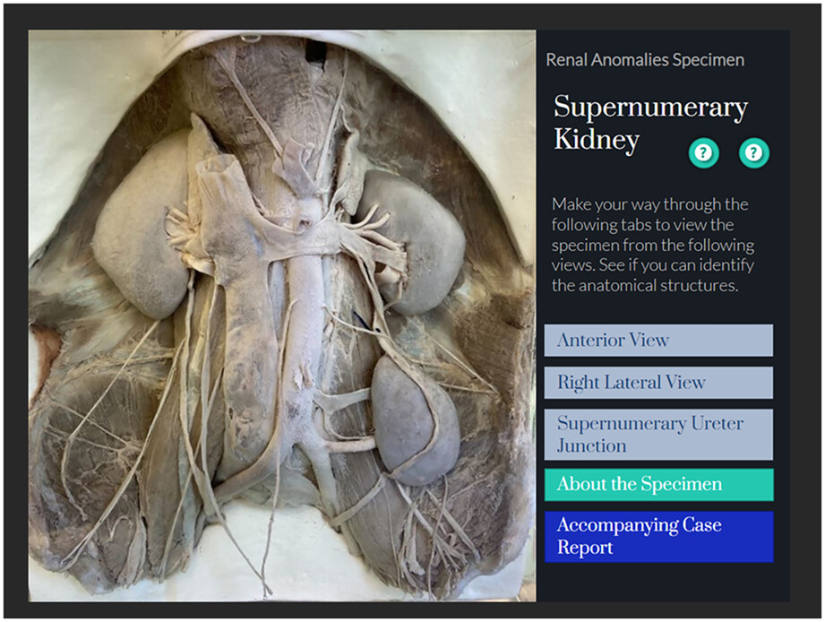 Reviving the anatomic past: Breathing new life into historic anatomical teaching tools
