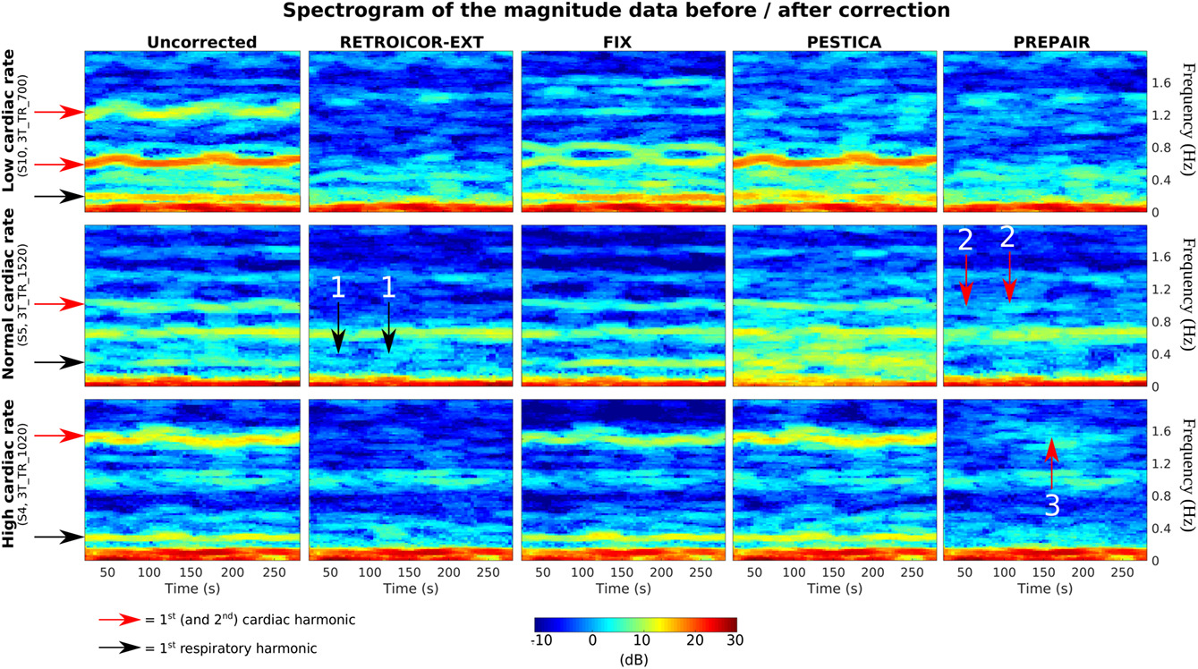 Unsupervised physiological noise correction of functional magnetic resonance imaging data using phase and magnitude information (PREPAIR)