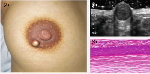 Details are in the caption following the image Details are in the caption following the image