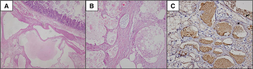 Details are in the caption following the image Details are in the caption following the image