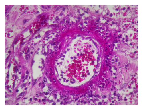 Details are in the caption following the image Details are in the caption following the image