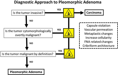Pleomorphic adenoma: the great mimicker of malignancy