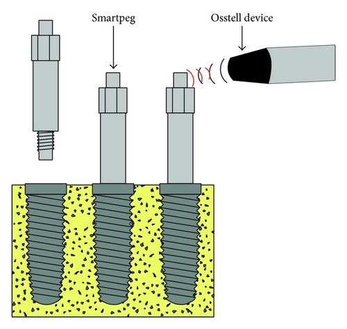 Details are in the caption following the image