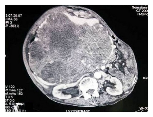 Details are in the caption following the image