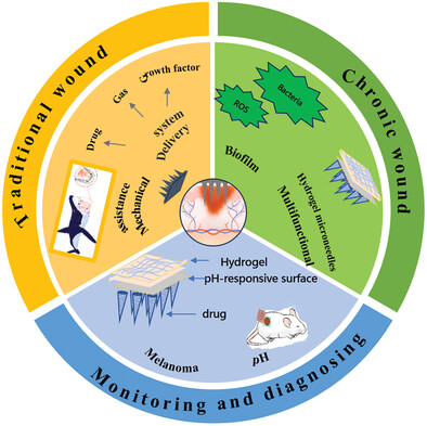 Functional Microneedle Patch for Wound Healing and Biological Diagnosis and Treatment