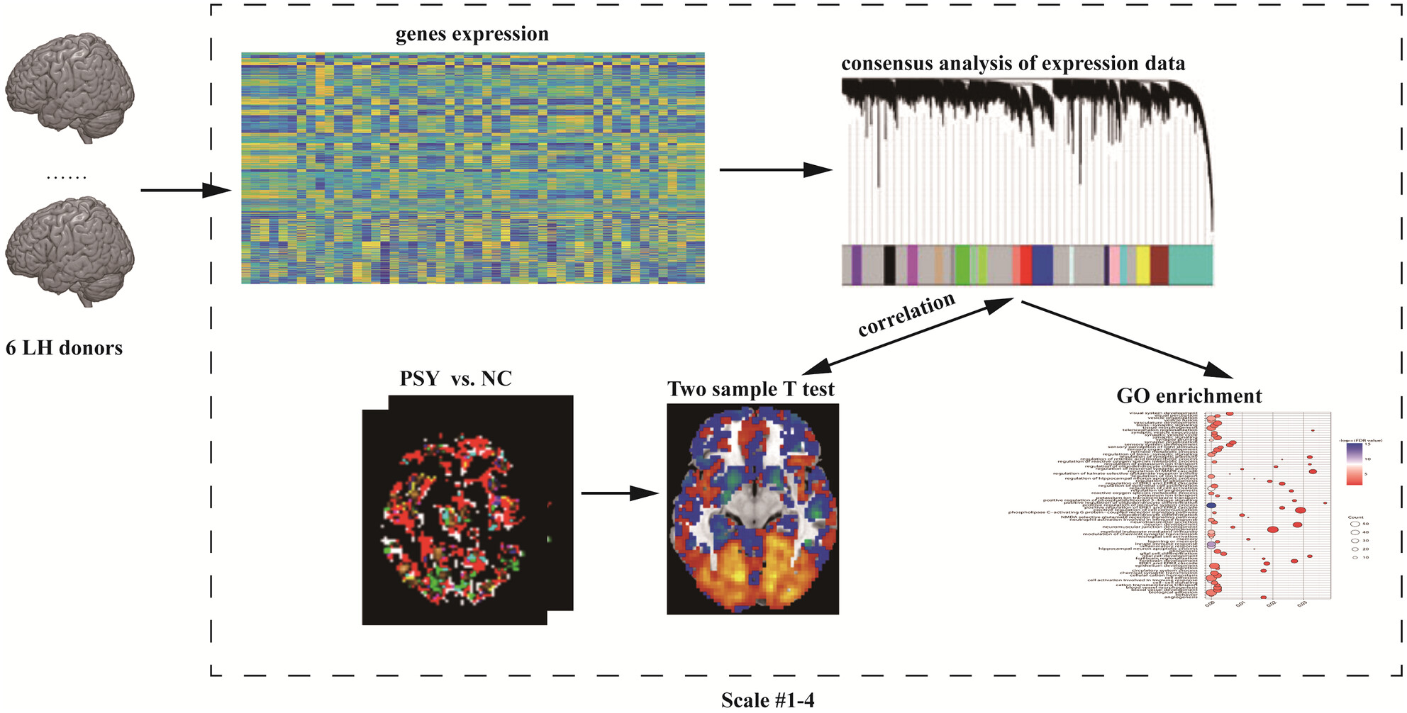 Unraveling multi-scale neuroimaging biomarkers and molecular foundations for schizophrenia: A combined multivariate pattern analysis and transcriptome-neuroimaging association study