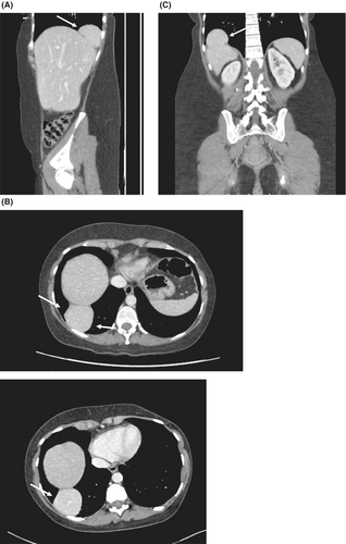 Details are in the caption following the image Details are in the caption following the image