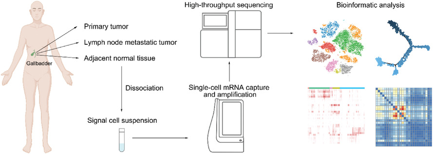 Diversity and intratumoral heterogeneity in human gallbladder cancer progression revealed by single-cell RNA sequencing