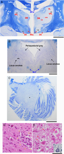 Details are in the caption following the image Details are in the caption following the image