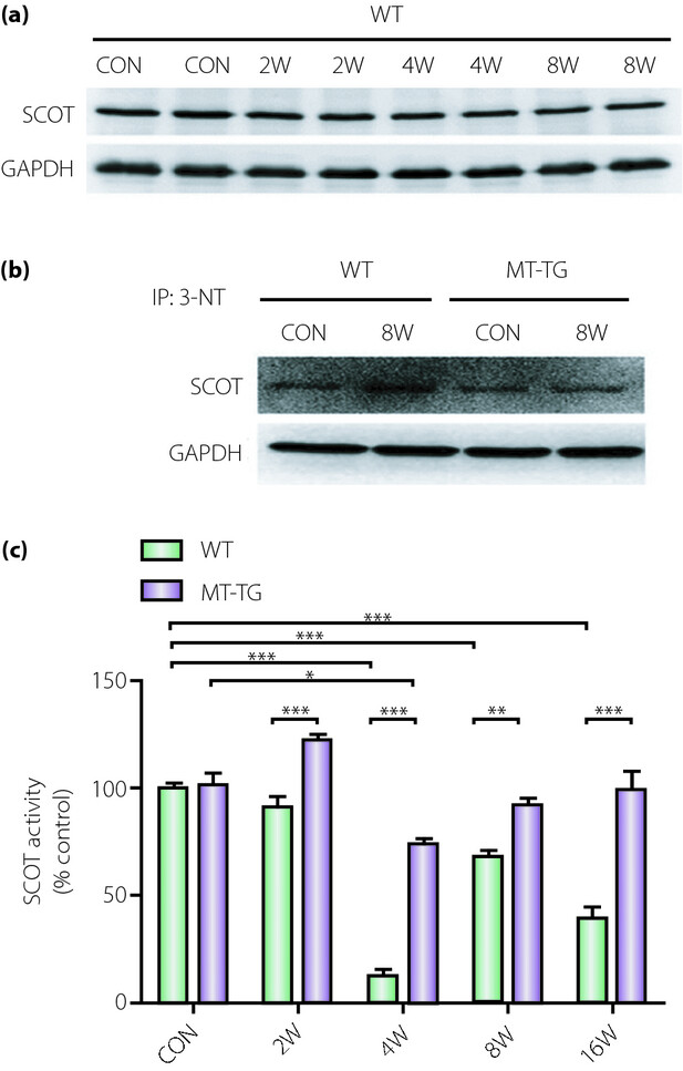 Diabetic cardiomyopathy and its mechanisms: Role of oxidative stress and damage