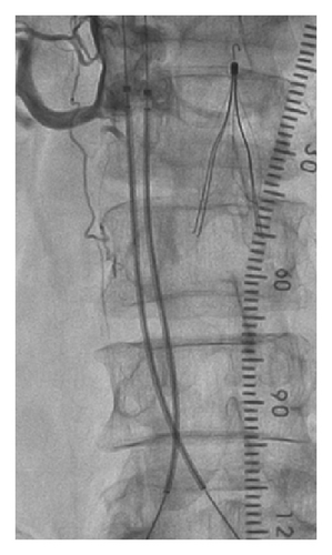 Details are in the caption following the image