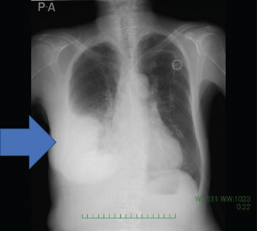 Details are in the caption following the image
