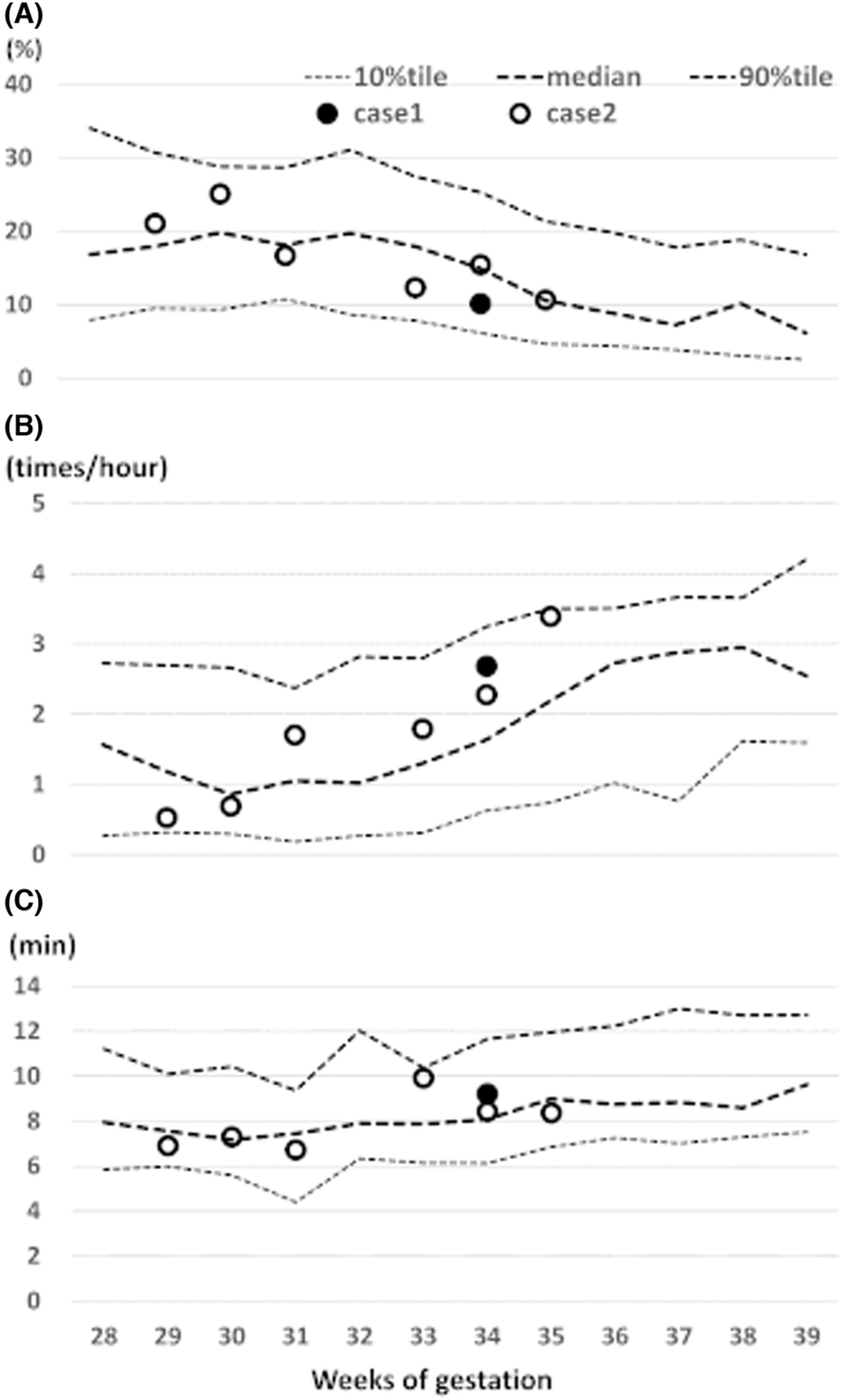 Counting gross fetal movement using a fetal movement acceleration measurement recorder in two fetuses with gastroschisis