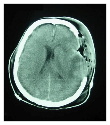 Details are in the caption following the image Details are in the caption following the image