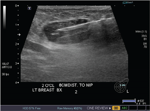 Details are in the caption following the image Details are in the caption following the image