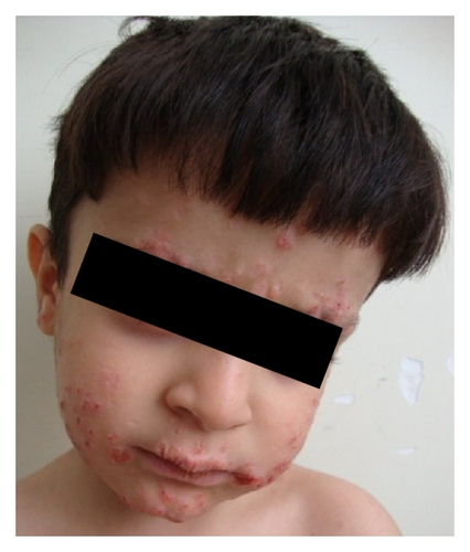 Details are in the caption following the image Details are in the caption following the image
