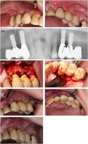 Details are in the caption following the image Details are in the caption following the image