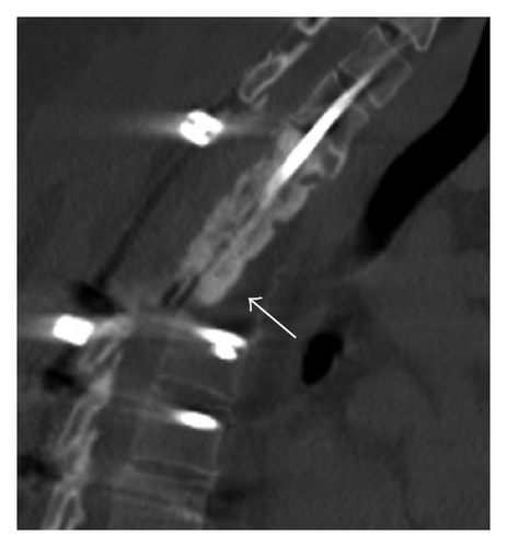 Details are in the caption following the image