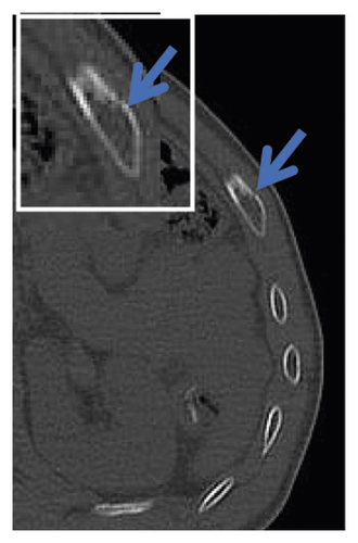 Details are in the caption following the image