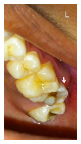 Details are in the caption following the image