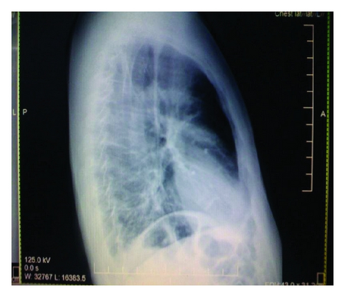 Details are in the caption following the image