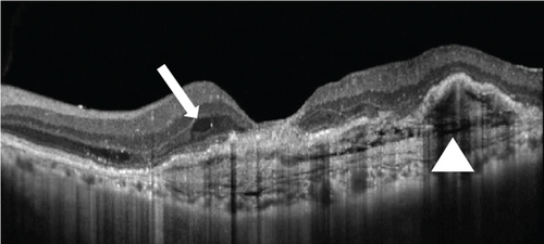 Details are in the caption following the image Details are in the caption following the image