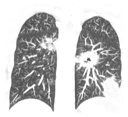 Details are in the caption following the image