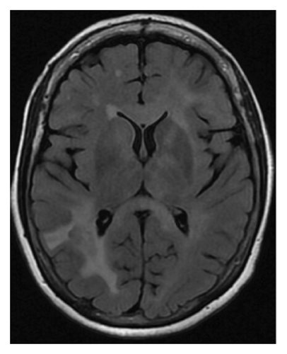 Details are in the caption following the image