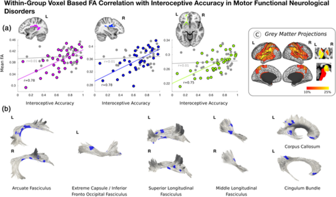 Individual differences in interoceptive accuracy and prediction error in motor functional neurological disorders: A DTI study
