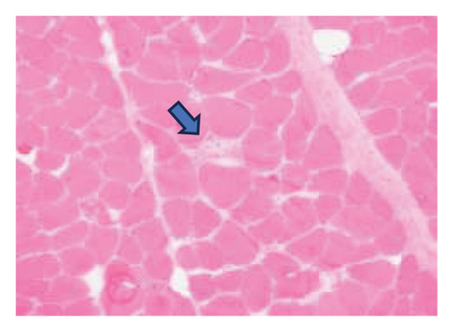 Details are in the caption following the image