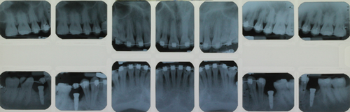 Details are in the caption following the image Details are in the caption following the image
