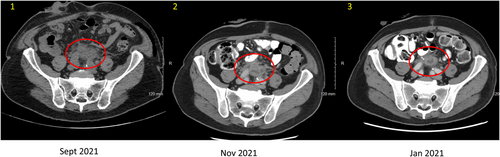 Details are in the caption following the image Details are in the caption following the image