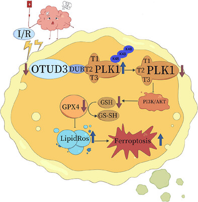 The deubiquitinase OTUD3 plays a neuroprotective role by reducing ferroptosis induced by cerebral ischaemia reperfusion via stabilizing PLK1 via deubiquitination