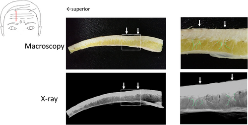 Details are in the caption following the image Details are in the caption following the image