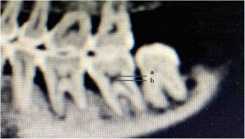 Details are in the caption following the image