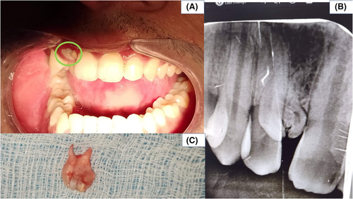 Details are in the caption following the image Details are in the caption following the image