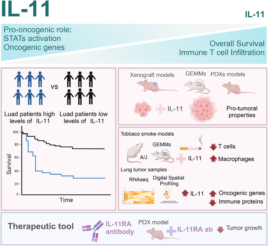 Interleukin-11 promotes lung adenocarcinoma tumourigenesis and immune evasion Issue 7, 2025