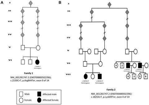 Biallelic truncating variants in the muscular A-type lamin-interacting protein (MLIP) gene cause myopathy with hyperCKemia