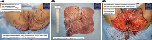Details are in the caption following the image Details are in the caption following the image