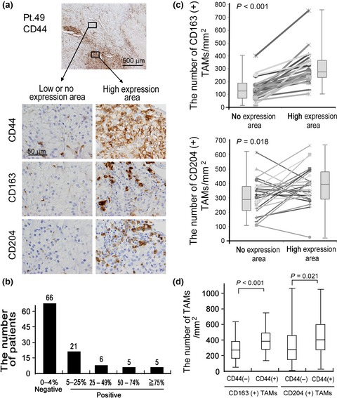 Infiltration of tumor-associated macrophages is involved in CD44 expression in clear cell renal cell carcinoma