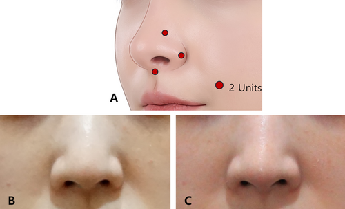Details are in the caption following the image Details are in the caption following the image