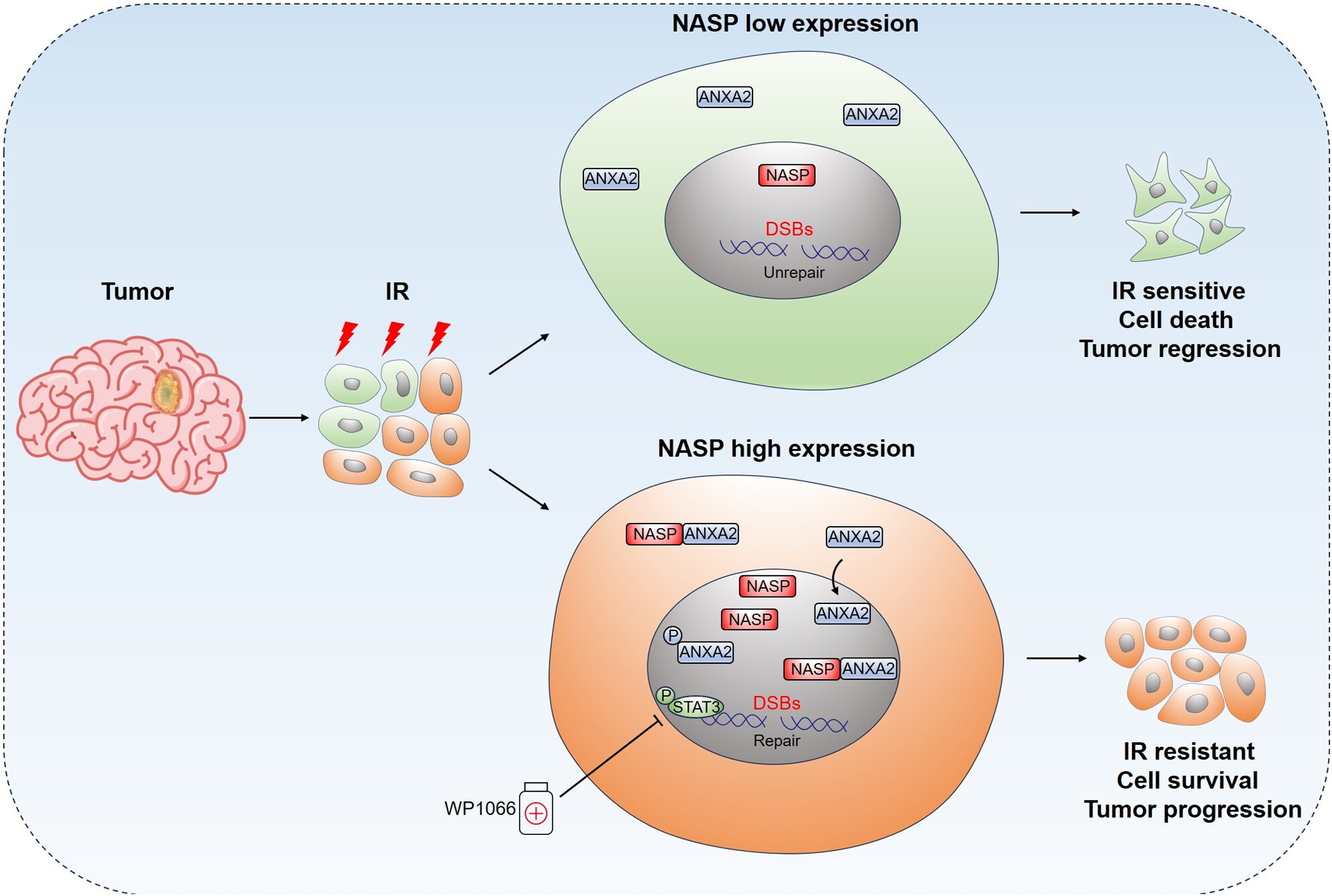 Nuclear autoantigenic sperm protein facilitates glioblastoma progression and radioresistance by regulating the ANXA2/STAT3 axis