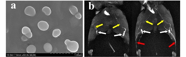 Hyaluronic Acid-Gadolinium Complex Nanospheres as Lymphatic System-Specific Contrast Agent for Magnetic Resonance Imaging