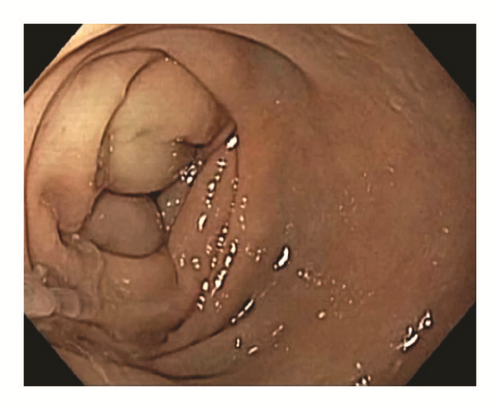 Details are in the caption following the image Details are in the caption following the image