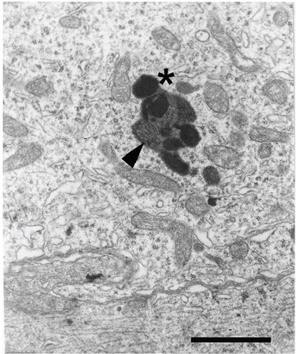 Details are in the caption following the image